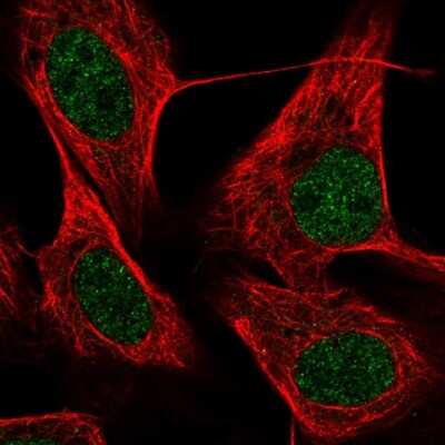 Immunocytochemistry/ Immunofluorescence: ZNF674 Antibody [NBP2-55718]