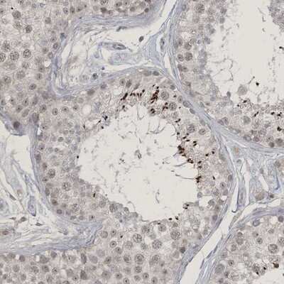 Immunohistochemistry-Paraffin: ZNF674 Antibody [NBP1-93452]