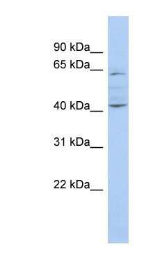 Western Blot: ZNF674 Antibody [NBP1-91371]