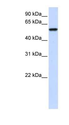 Western Blot: ZNF675 Antibody [NBP1-79700]