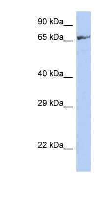 Western Blot: ZNF676 Antibody [NBP1-79342]