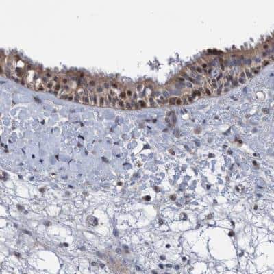 Immunohistochemistry: ZNF677 Antibody [NBP1-82676]