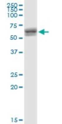 Western Blot: ZNF680 Antibody [H00340252-B01P]