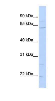 Western Blot: ZNF680 Antibody [NBP1-79428]