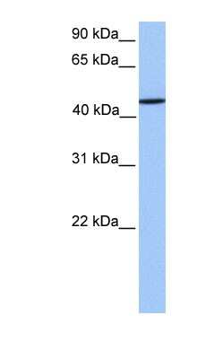 Western Blot: ZNF680 Antibody [NBP1-79429]