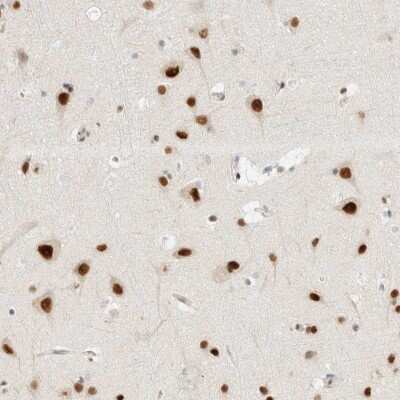 Immunohistochemistry-Paraffin: ZNF683 Antibody [NBP2-48569]
