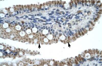 Immunohistochemistry-Paraffin: ZNF683 Antibody [NBP1-80185]