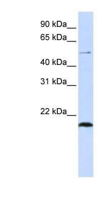 Western Blot: ZNF683 Antibody [NBP1-80186]