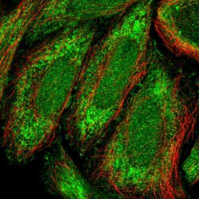 Immunocytochemistry/ Immunofluorescence: ZNF684 Antibody [NBP2-31751]