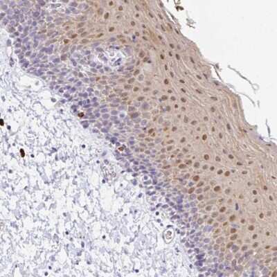 Immunohistochemistry-Paraffin: ZNF684 Antibody [NBP2-31751]