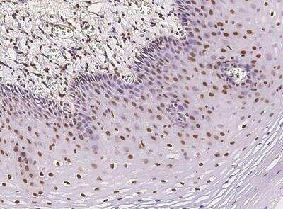 Immunohistochemistry-Paraffin: ZNF684 Antibody [NBP3-05978]