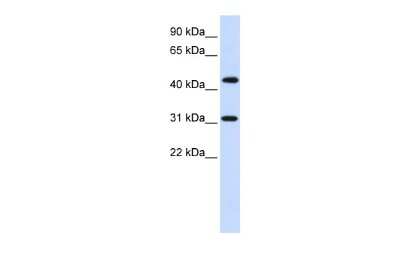 Western Blot: ZNF684 Antibody [NBP2-83890]