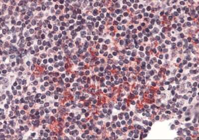 Immunohistochemistry: ZNF687 Antibody - BSA Free [NBP2-41128]