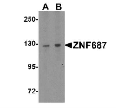 Western Blot: ZNF687 AntibodyBSA Free [NBP2-41175]