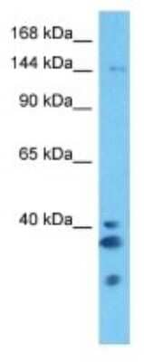 Western Blot: ZNF687 Antibody [NBP3-10509]