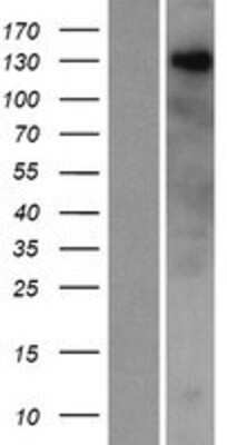 Western Blot: ZNF687 Overexpression Lysate [NBP2-06598]