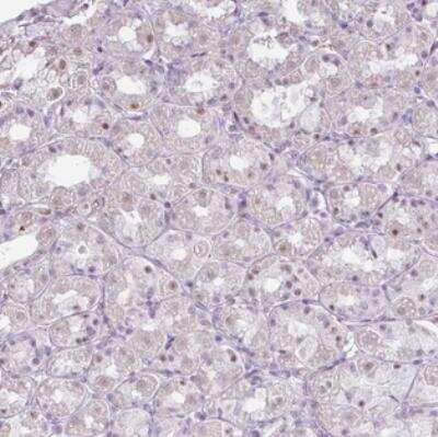 Immunohistochemistry: ZNF688 Antibody [NBP2-30749]