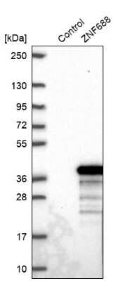 Western Blot: ZNF688 Antibody [NBP2-30749]