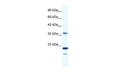 Western Blot: ZNF688 Antibody [NBP2-83891]