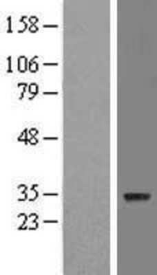 Western Blot: ZNF688 Overexpression Lysate [NBL1-18227]