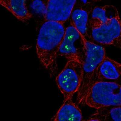 Immunocytochemistry/ Immunofluorescence: ZNF689 Antibody [NBP2-33706]