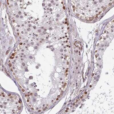 Immunohistochemistry-Paraffin: ZNF689 Antibody [NBP2-33706]