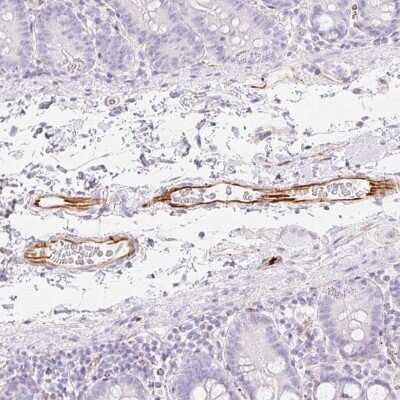 Immunohistochemistry-Paraffin: ZNF689 Antibody [NBP2-33752]