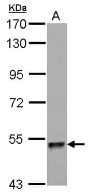 Western Blot: ZNF689 Antibody [NBP2-21040]