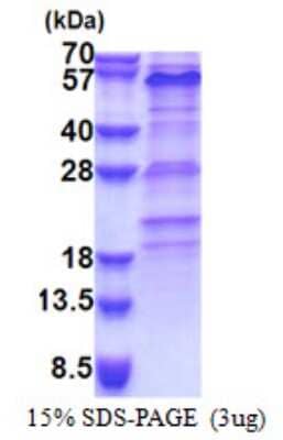 SDS-PAGE: Recombinant Human ZNF689 His Protein [NBP2-22958]