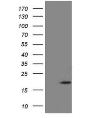 Western Blot: ZNF69 Antibody (OTI3C3)Azide and BSA Free [NBP2-74954]