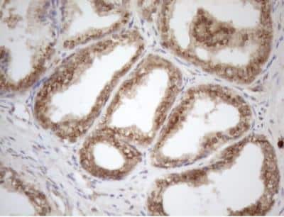 Immunohistochemistry-Paraffin: ZNF69 Antibody (OTI3C3) [NBP2-46455]