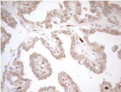 Immunohistochemistry-Paraffin: ZNF69 Antibody (OTI3C3) [NBP2-46455]