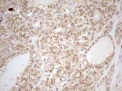Immunohistochemistry-Paraffin: ZNF69 Antibody (OTI3C3) [NBP2-46455]