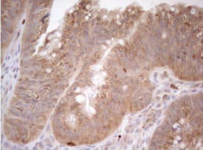 Immunohistochemistry-Paraffin: ZNF69 Antibody (OTI3C3) [NBP2-46455]