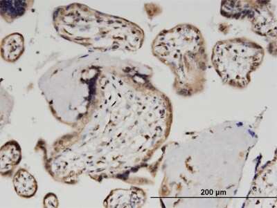 Immunohistochemistry-Paraffin: ZNF690 Antibody (2E8) [H00146050-M03]