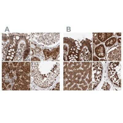 Immunohistochemistry-Paraffin: ZNF690 Antibody [NBP1-89831]