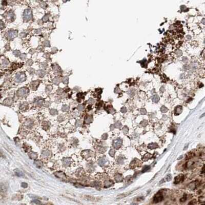 Immunohistochemistry-Paraffin: ZNF690 Antibody [NBP1-89831]