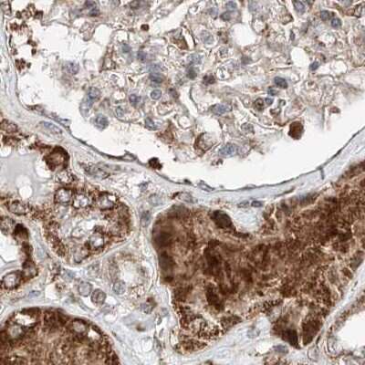 Immunohistochemistry-Paraffin: ZNF690 Antibody [NBP1-89831]