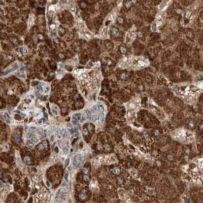 Immunohistochemistry-Paraffin: ZNF690 Antibody [NBP1-89831]