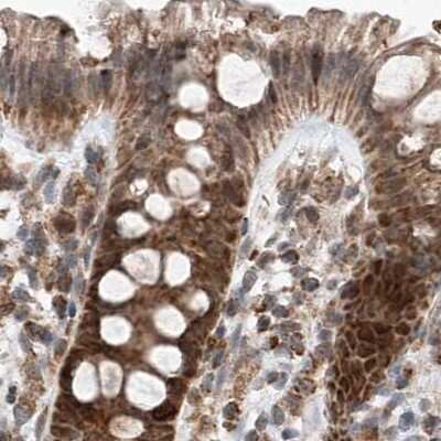Immunohistochemistry-Paraffin: ZNF690 Antibody [NBP1-89831]