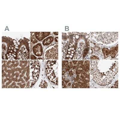 Immunohistochemistry-Paraffin: ZNF690 Antibody [NBP1-89832]
