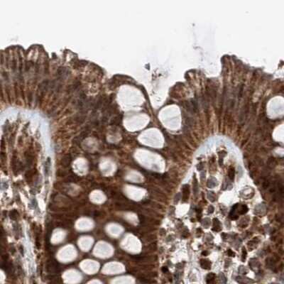 Immunohistochemistry-Paraffin: ZNF690 Antibody [NBP1-89832]