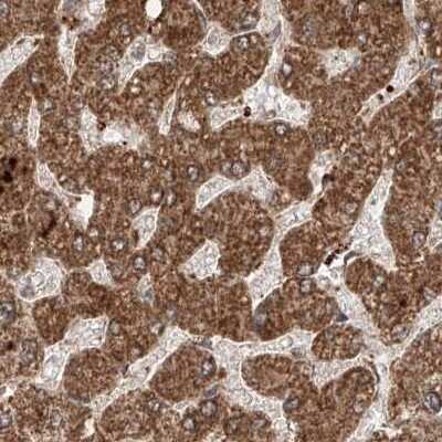 Immunohistochemistry-Paraffin: ZNF690 Antibody [NBP1-89832]