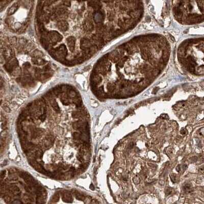 Immunohistochemistry-Paraffin: ZNF690 Antibody [NBP1-89832]