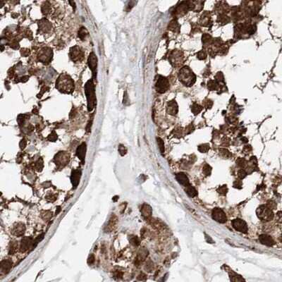 Immunohistochemistry-Paraffin: ZNF690 Antibody [NBP1-89832]