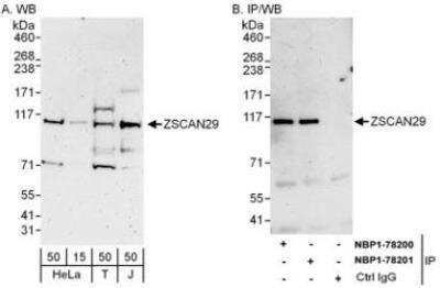 Western Blot: ZNF690 Antibody [NBP1-78201]