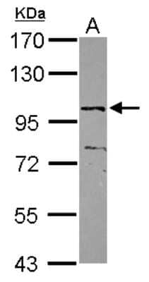 Western Blot: ZNF690 Antibody [NBP2-21042]