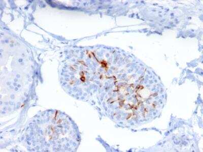 Immunohistochemistry-Paraffin: ZNF690 Antibody (ZSCAN29/2610) - Azide and BSA Free [NBP2-79881]