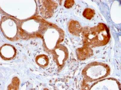 Immunohistochemistry-Paraffin: ZNF690 Antibody (ZSCAN29/2610) - Azide and BSA Free [NBP2-79881]