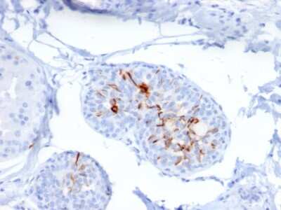 Immunohistochemistry-Paraffin: ZNF690 Antibody (ZSCAN29/2610) [NBP2-79746]